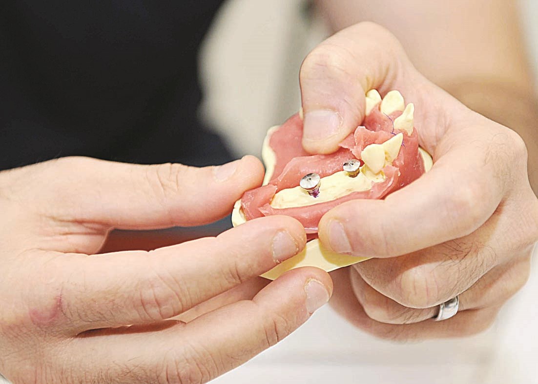 نموذج لكيفية فتح اللثة