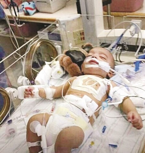 u0627u0644u0637u0641u0644 u0627u0644u0645u0631u064au0636