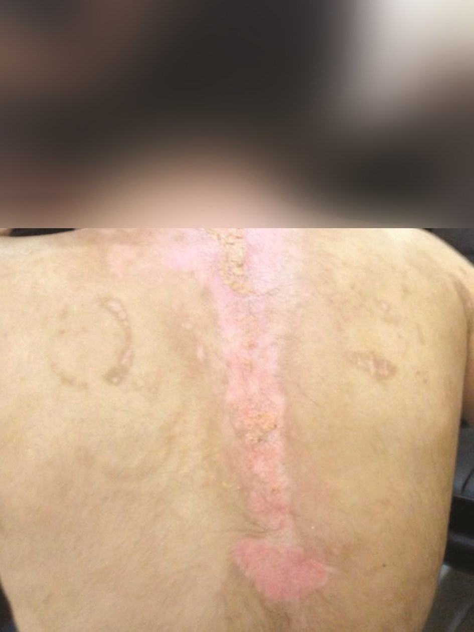 u0627u062bu0627u0631 u0627u0644u062au0639u0630u064au0628 u0639u0644u0649 u062cu0633u062f u0627u0644u0637u0641u0644u0629