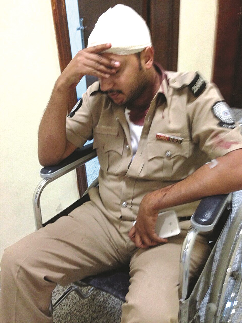 المجني عليه معصوب الرأس داخل مستشفى العدان