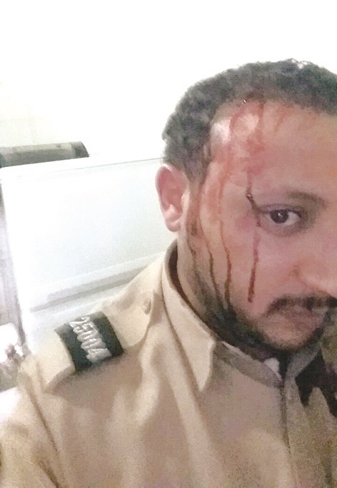 u0627u0644u062fu0645u0627u0621 u062au0633u064au0644 u0645u0646 u0631u0623u0633 u0627u0644u0639u0633u0643u0631u064a