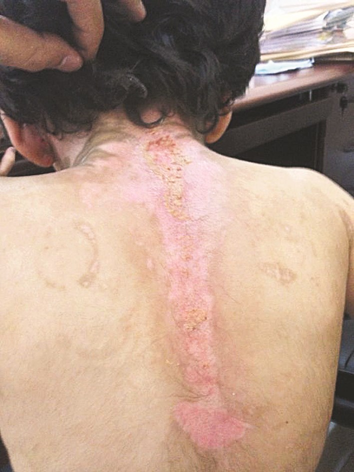 u0625u0635u0627u0628u0627u062a u0627u0644u0637u0641u0644u0629