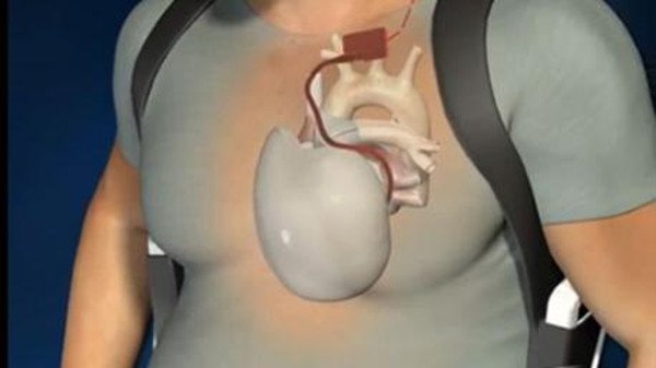 u0642u0644u0628 u0635u0646u0627u0639u064a