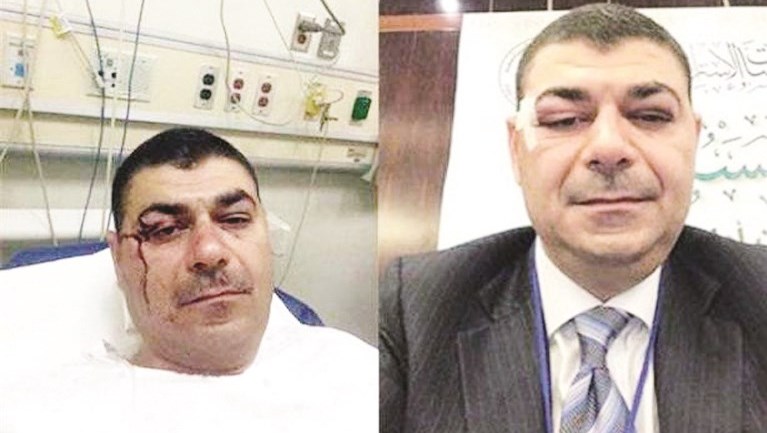 u062du064au062fu0631 u0627u0644u0645u0644u0627 u0642u0628u0644 u0648u0628u0639u062f u0625u0635u0627u0628u062au0647