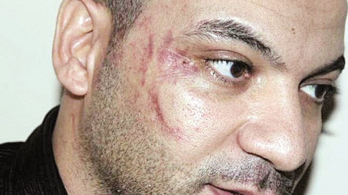 u0622u062bu0627u0631 u0627u0644u0627u0639u062au062fu0627u0621 u0639u0644u0649 u0648u062cu0647 u0627u0644u0639u0627u0645u0644 u0627u0644u0645u0635u0631u064a