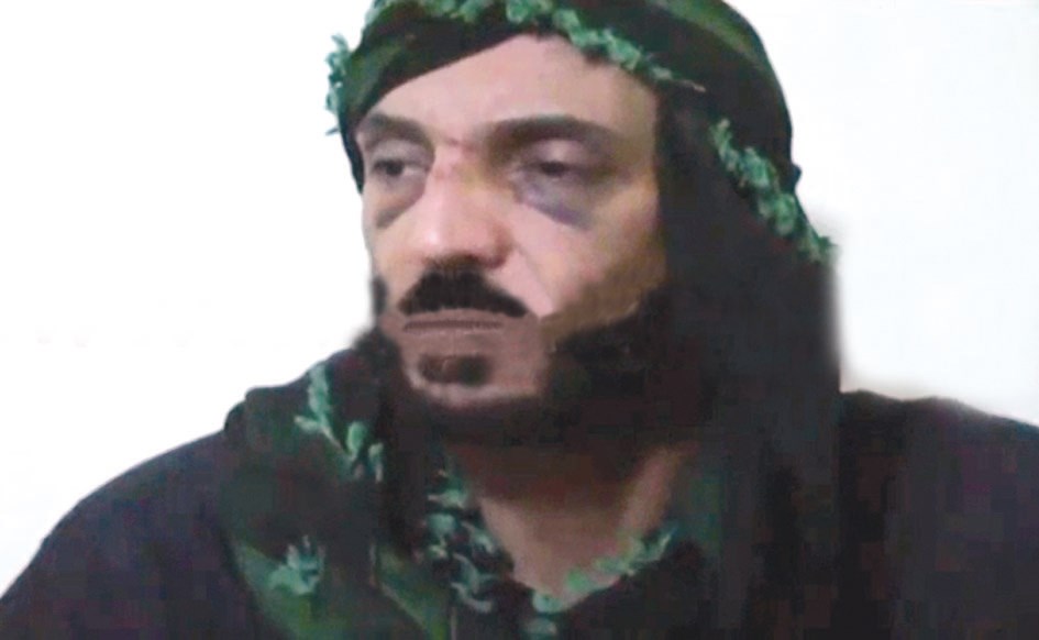 u0622u062bu0627u0631 u0627u0644u0636u0631u0628 u0639u0644u0649 u0648u062cu0647 u0647u0646u064au0628u0639u0644