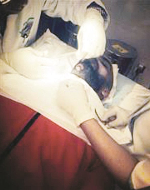 u0627u0644u0643u0646u062fu0631u064a u062eu0644u0627u0644 u0639u0645u0644u064au0629 u00abu0627u0644u062au0642u0637u064au0628u00bb