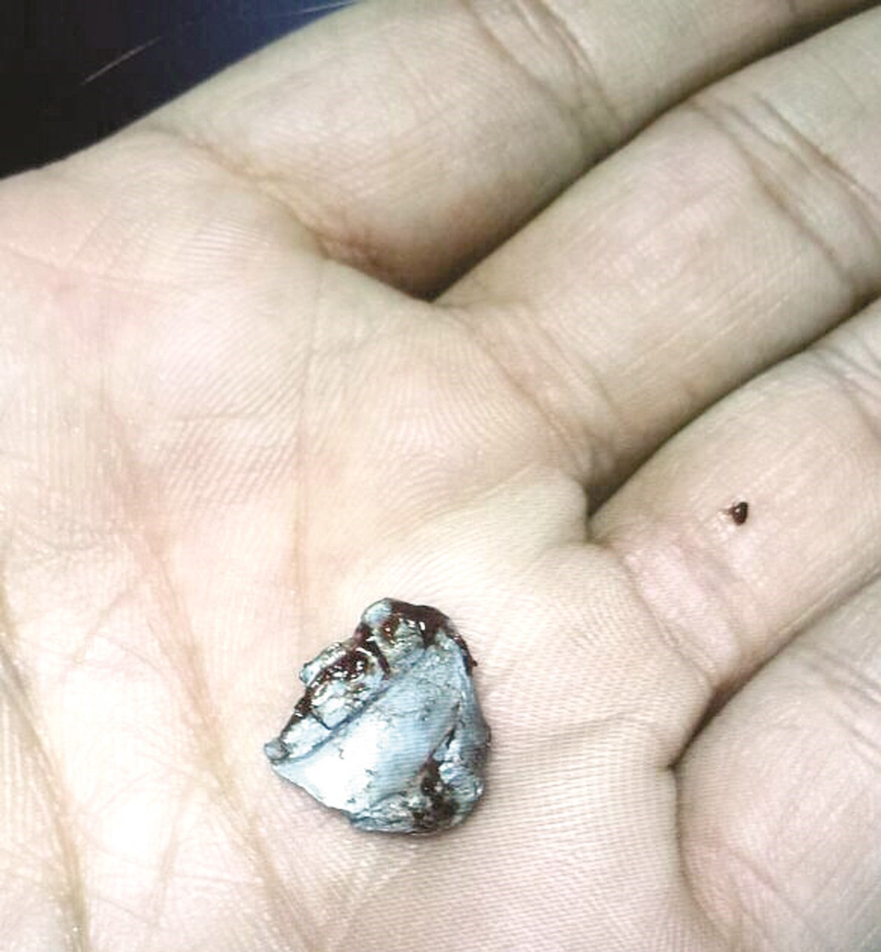 u0637u0644u0642u0629 u00abu0623u0645 u0635u062cu0645u0629u00bb u0627u0644u062au064a u0627u0633u062au0642u0631u0651u062a u0641u064a u0628u0637u0646 u0627u0644u0645u062cu0646u064a u0639u0644u064au0647