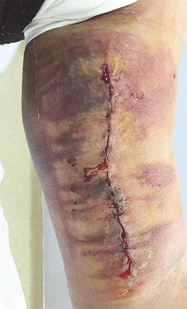 u0647u0630u0627 u0645u0627 u062cu0631u0651u062au0647 u00abu0623u062du0644u0627u0645 u0627u0644u0639u0636u0644u0627u062au00bb u0639u0644u0649 u0623u062du062f u0627u0644u0631u064au0627u0636u064au064au0646