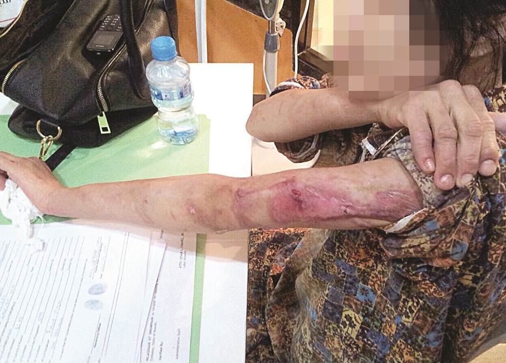 u0622u062bu0627u0631 u0627u0644u062au0639u0630u064au0628 u0639u0644u0649 u0630u0631u0627u0639 u0627u0644u062eu0627u062fu0645u0629