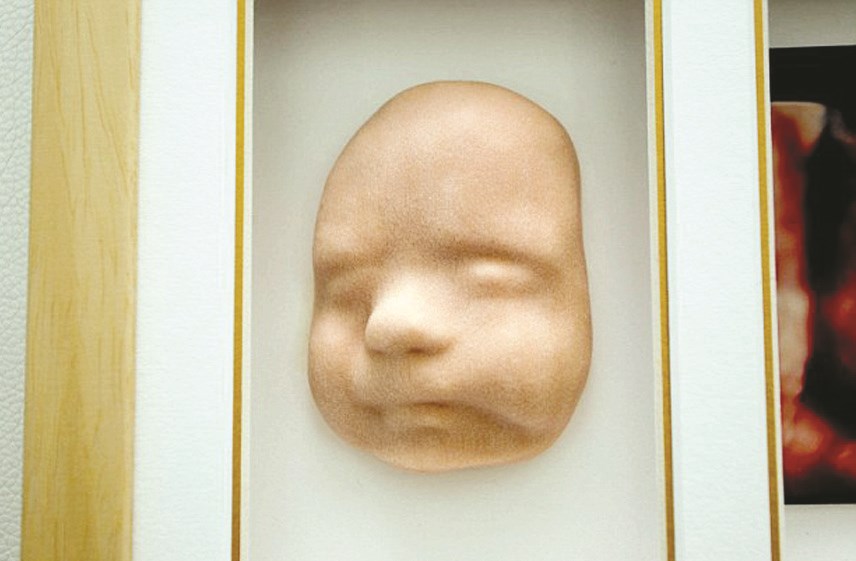 u0635u0648u0631u0629 u0645u0642u0631u0651u0628u0629 u0644u0645u062cu0633u0651u0645 u0648u062cu0647 u062cu0646u064au0646 u0628u0631u0627u0645u0644u064a