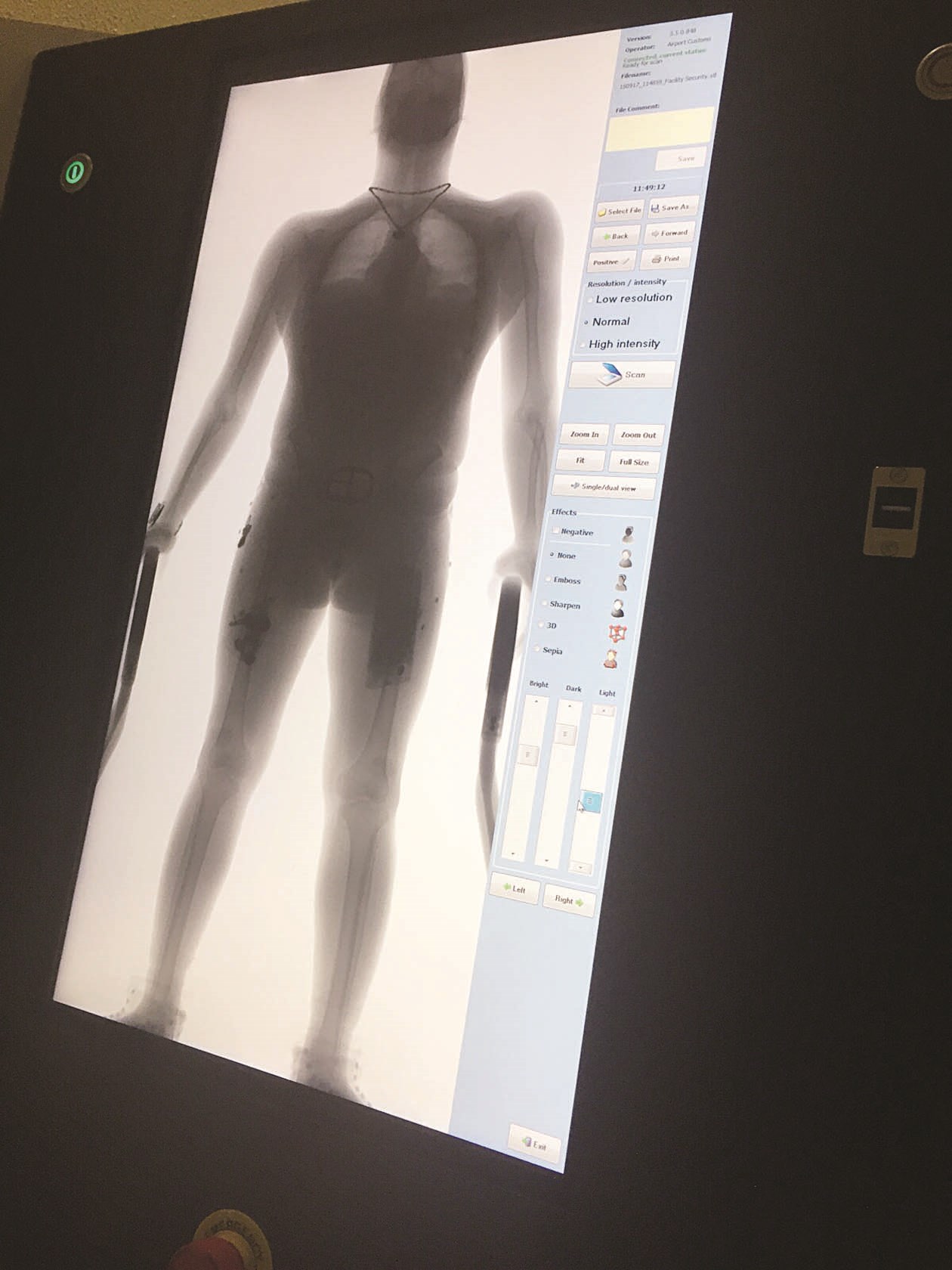 الجهاز يكشف ما يحمله المسافر في أحشائه