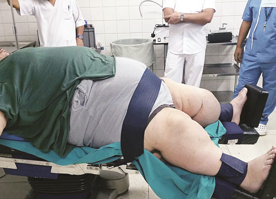 تجهيز المريض للعملية