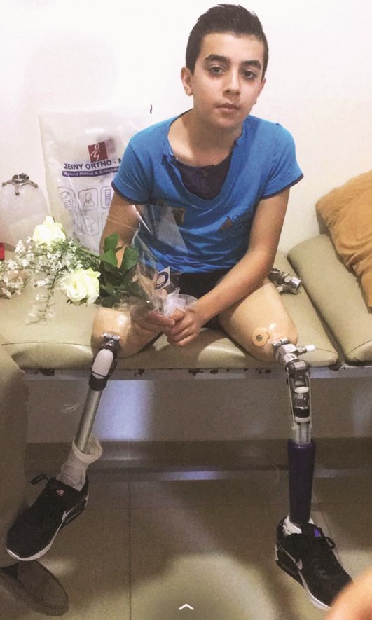 u0642u0635u064a u0639u0644u0648u0634