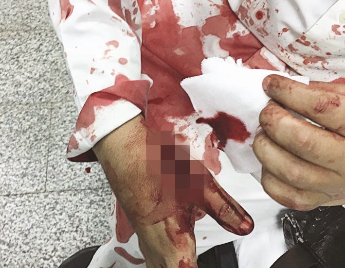 u0627u0644u062fu0645u0627u0621 u00abu0623u063au0631u0642u062au00bb u062bu064au0627u0628 u0631u062cu0644 u0627u0644u0645u0628u0627u062du062b