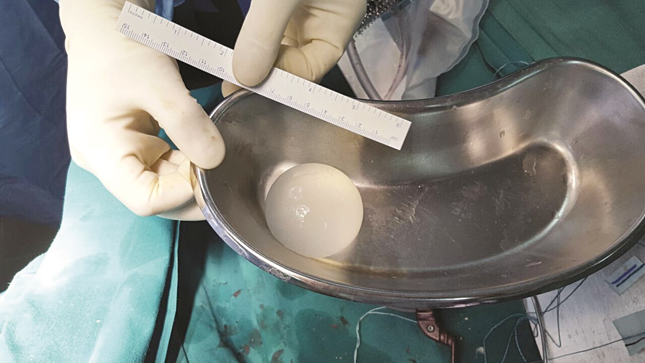 u0627u0644u0643u064au0633u0629 u0627u0644u0645u0627u0626u064au0629 u0628u0639u062f u0633u062du0628u0647u0627