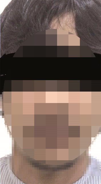 ... والإرتيري