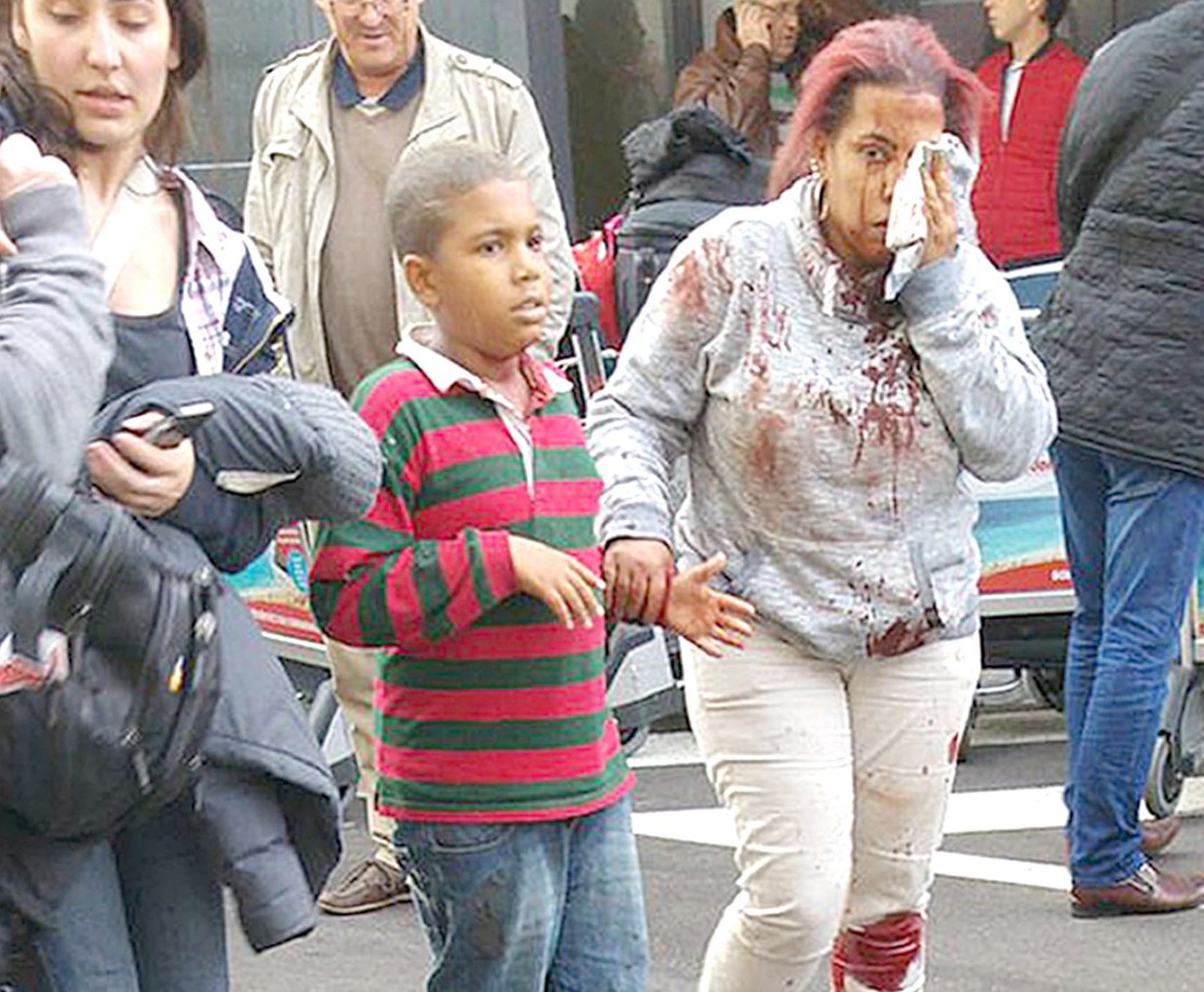 مصابون في التفجير الإرهابي الذي ضرب بروكسيل امس