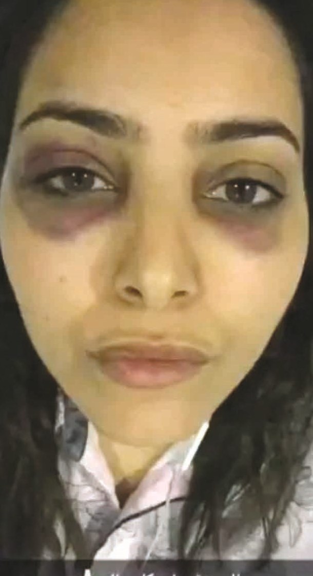 u0631u0636u0648u0636 u062du0648u0644 u0639u064au0646u064au0651 u0641u0627u0637u0645u0629 u0627u0644u0635u0641u064a