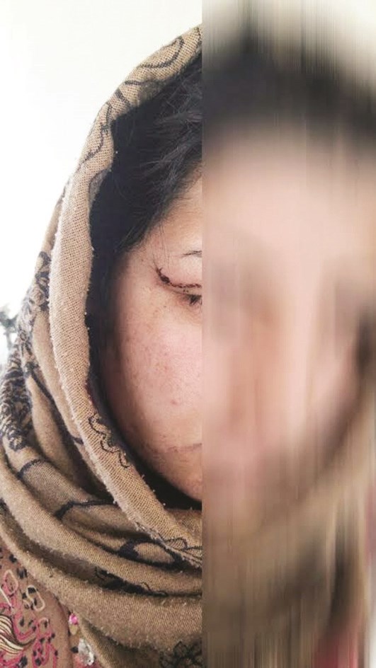 ... وآثار التعذيب على وجهها