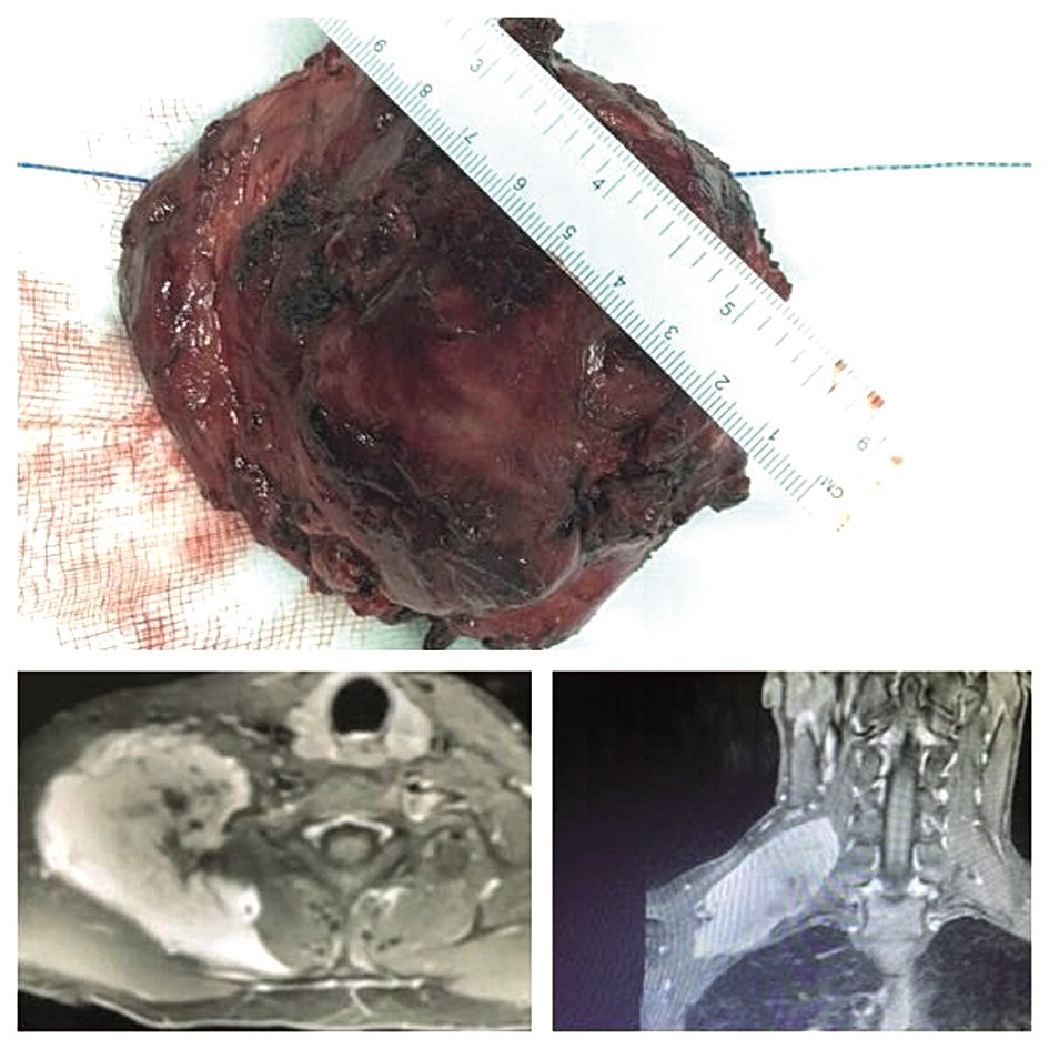 u0627u0644u0648u0631u0645 u0628u0639u062f u0627u0633u062au0626u0635u0627u0644u0647