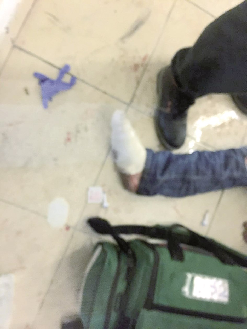 إصابات في السهرة