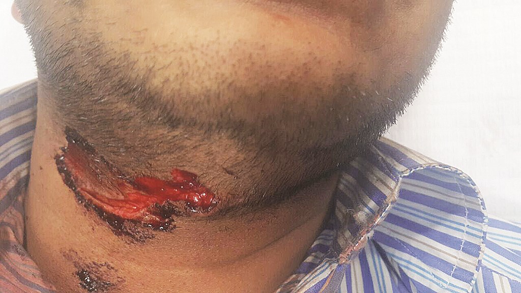 u0627u0644u062cu0627u0646u064au0627u0646 u0623u0635u0627u0628u0627 u0633u0627u0626u0642u0627u064b u0641u064a u0639u0646u0642u0647 u0628u0639u062f u0648u0627u0642u0639u0629 u0627u0644u0633u0644u0628