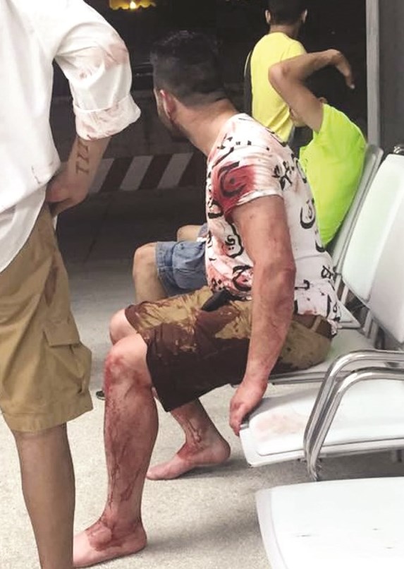 ... وصديقه المصاب