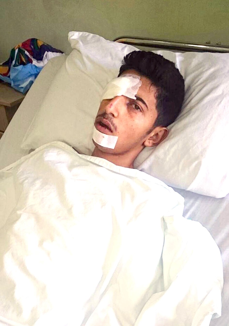 أحد الجرحى في المستشفى (أ ف ب)