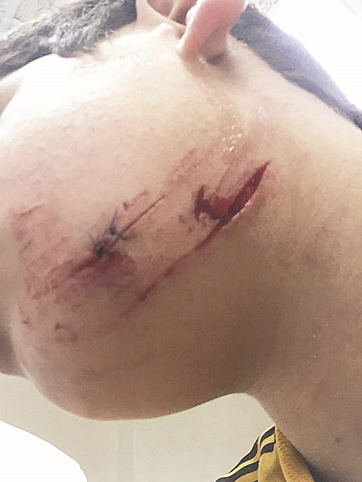 u0627u0644u062cu064fu0631u062d u0627u0644u0646u0627u0641u0630 u0641u064a u0631u0642u0628u0629 u0627u0644u0637u0641u0644