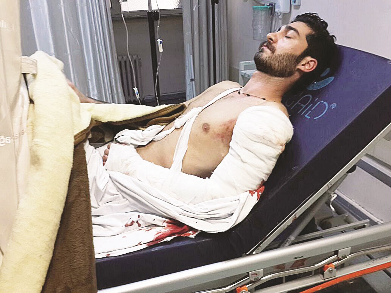 u0623u062du062f u062cu0631u062du0649 u0627u0644u0647u062cu0648u0645 (u0627u0644u0648u0643u0627u0644u0629 u0627u0644u0648u0637u0646u064au0629 u0644u0644u0625u0639u0644u0627u0645)