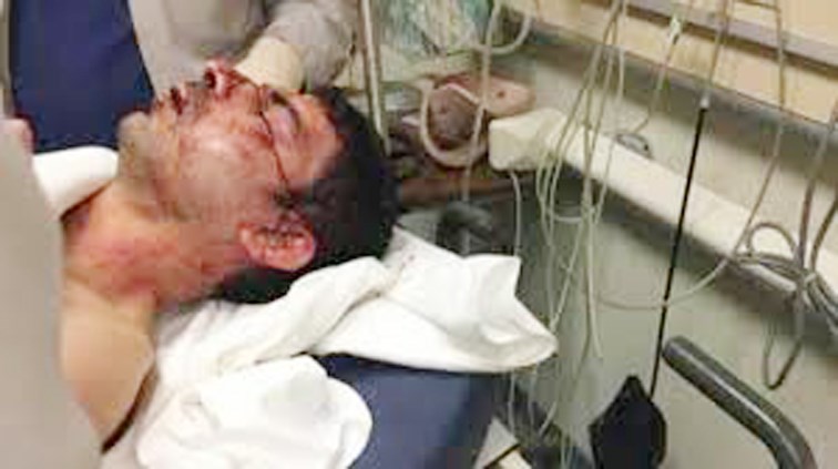 عمر العاصي خلال معالجته في المستشفى  (العربية.نت)