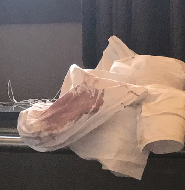 دماء على قميص انطوان