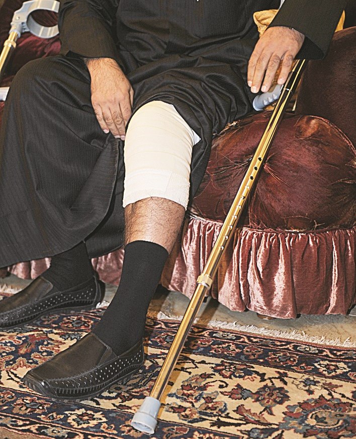 ... ويشير إلى إصابته