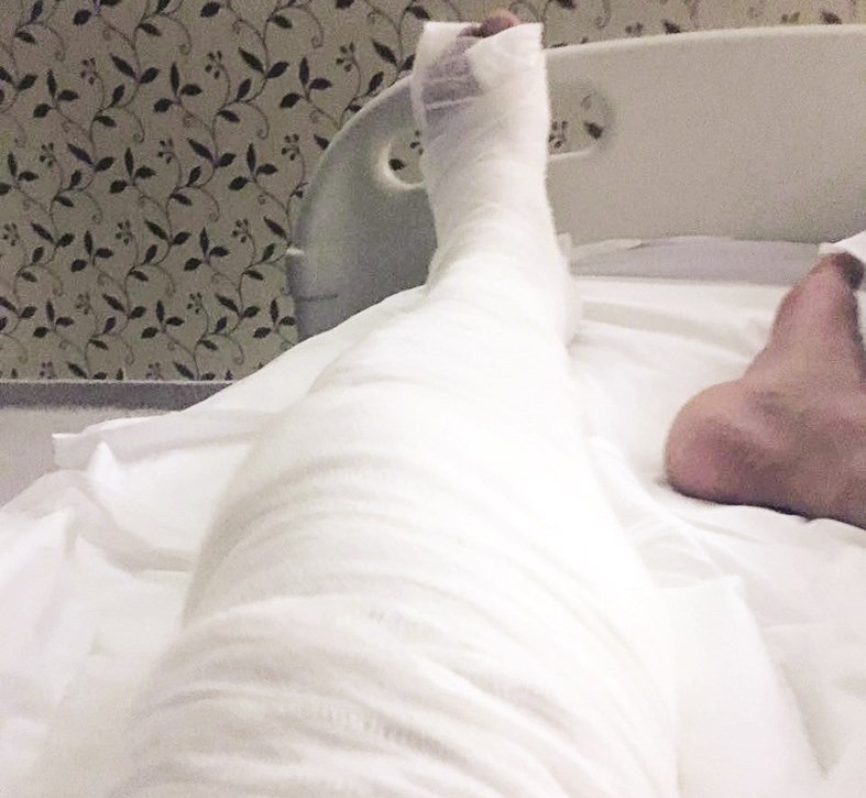 رجل علي جاسم بعد إصابته في مستشفى تركي