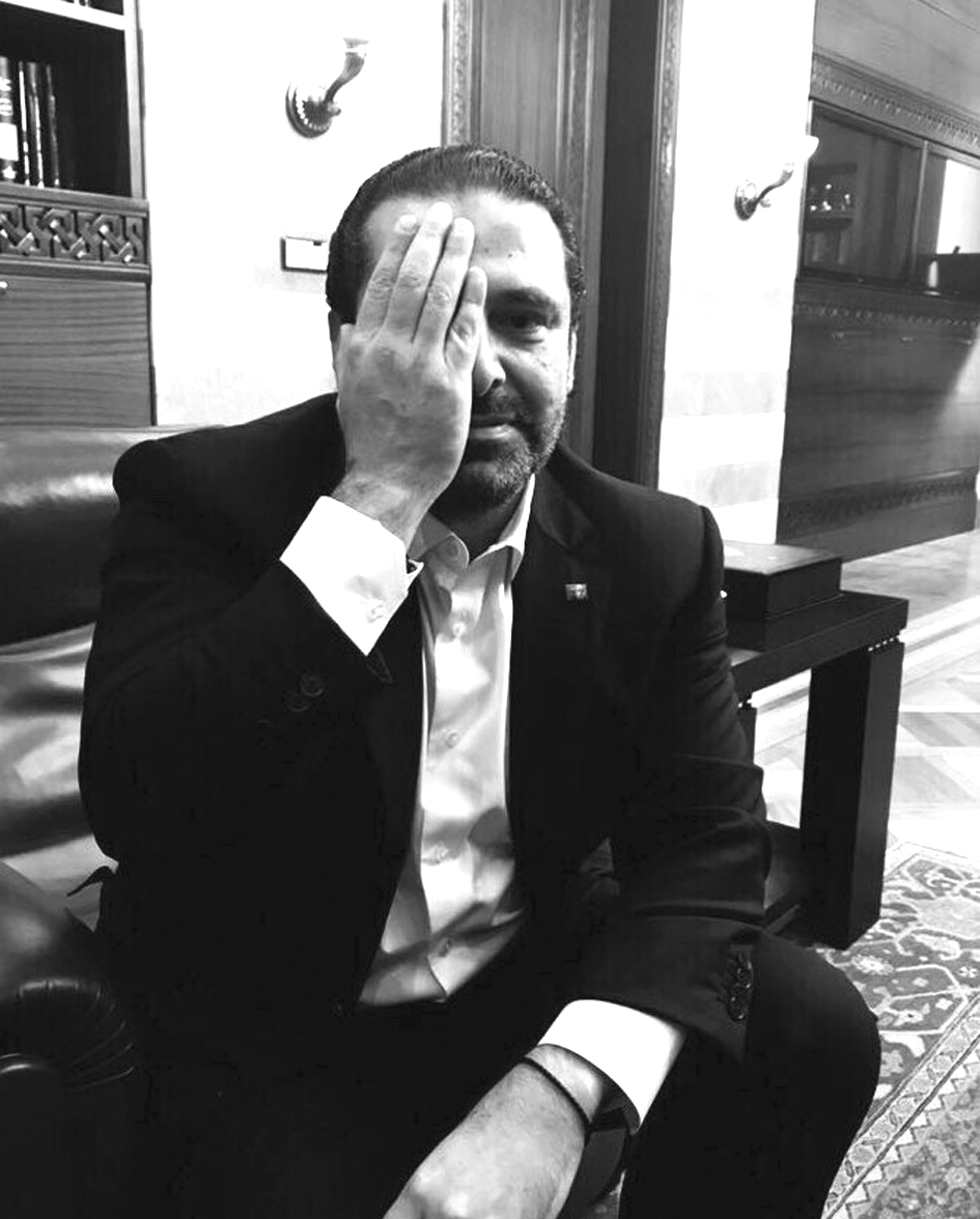 u0627u0644u0631u0626u064au0633 u0627u0644u062du0631u064au0631u064a u064au0636u0639 u064au062fu0647 u0639u0644u0649 u0639u064au0652u0646u0647 u0641u064a u0635u0648u0631u0629 u0646u0634u0631u0647u0627 u062au064eu0636u0627u0645u064fu0646u0627u064b u0645u0639 u0627u0644u0637u0641u0644 u0627u0644u0633u0648u0631u064a u0643u0631u064au0645 u0639u0628u062fu0627u0644u0631u062du0645u0646 u0627u0644u0630u064a u0641u0642u062f u0625u062du062fu0649 u0639u064au0646u064au0652u0647 u0648u0643u064fu0633u0631u062a u062cu0645u062cu0645u062au0647 u0648u0641u064eu0642u064eu062fu064e u0648u0627u0644u062fu062au0647 u0628u0642u0635u0641 u0644u0642u0648u0627u062a u0627u0644u0646u0638u0627u0645 u0639u0644u0649 u0627u0644u063au0648u0637u0629 u0627u0644u0634u0631u0642u064au0629