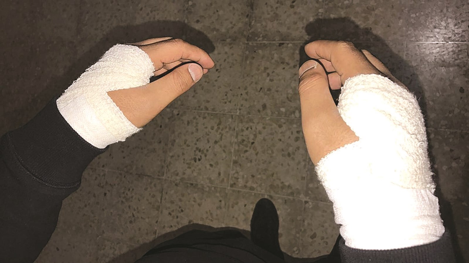 u062au062cu0628u064au0631 u064au062fu064a u0623u0634u0643u0646u0627u0646u064a u062cu0631u0627u0621 u0627u0644u0627u0639u062au062fu0627u0621