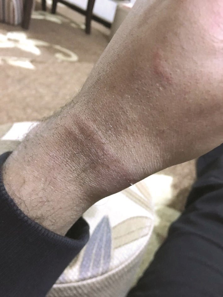 ... وآثار الكلبشات في معصمه