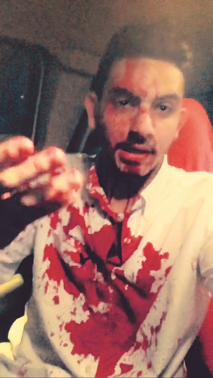 u0623u062bu0627u0631 u0627u0644u062fu0645u0627u0621 u0628u0627u062fu064au0629 u0639u0644u0649 u0648u062cu0647 u0627u0644u0644u0627u0639u0628