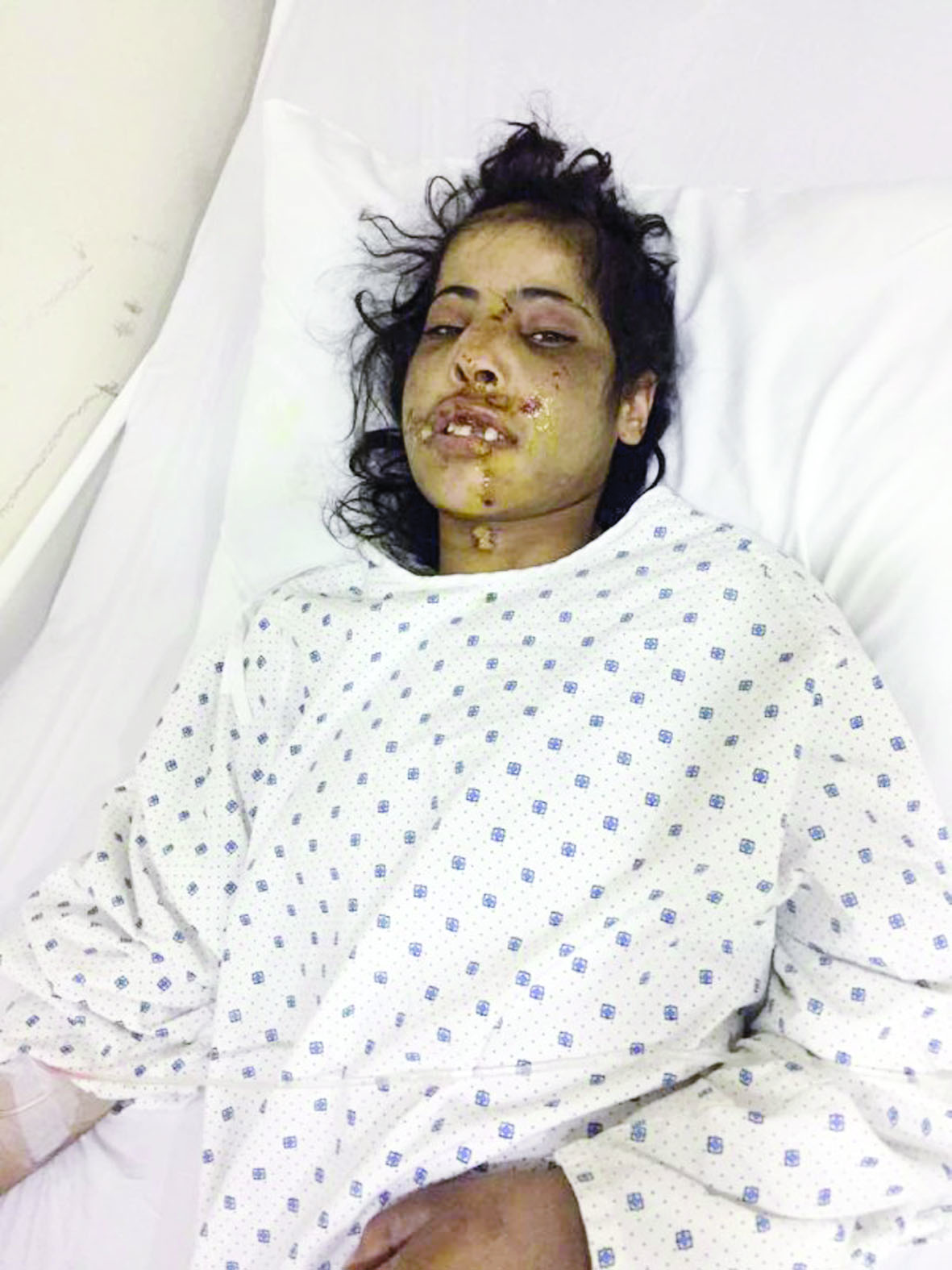 u0623u0645u0644 u0641u064a u0627u0644u0645u0633u062au0634u0641u0649