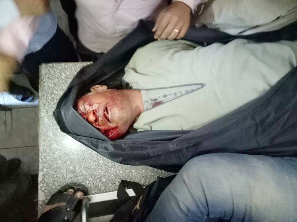 u0623u062du062f u0636u062du0627u064au0627 u0627u0644u0647u062cu0648u0645