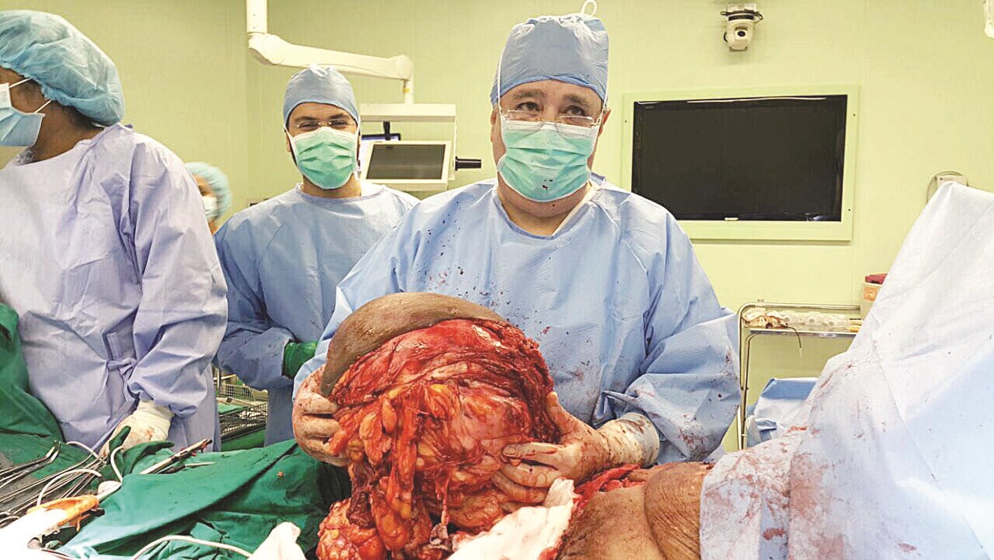 u0627u0633u062au0626u0635u0627u0644 u0643u0627u0645u0644 u0627u0644u0648u0631u0645