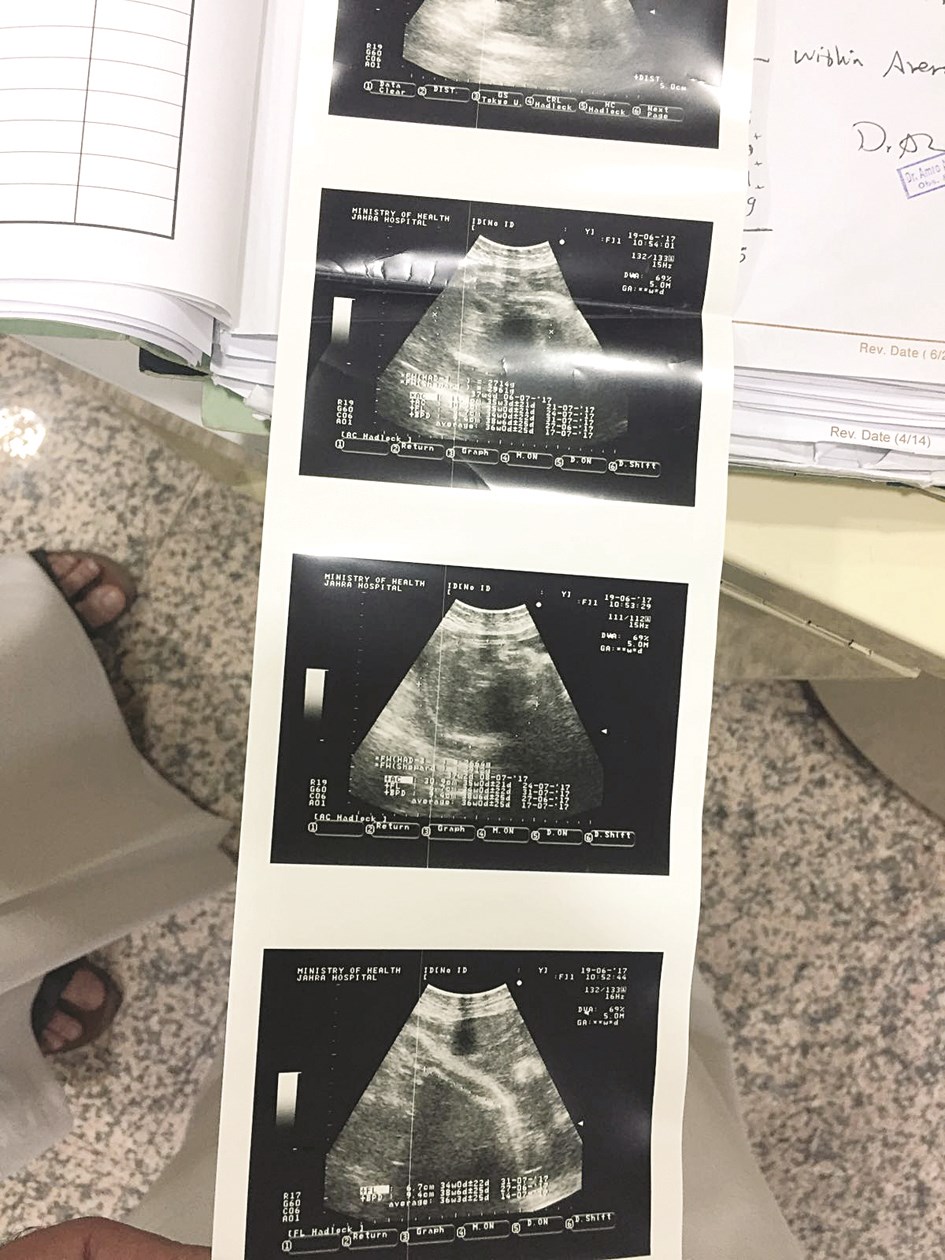 صور السونار