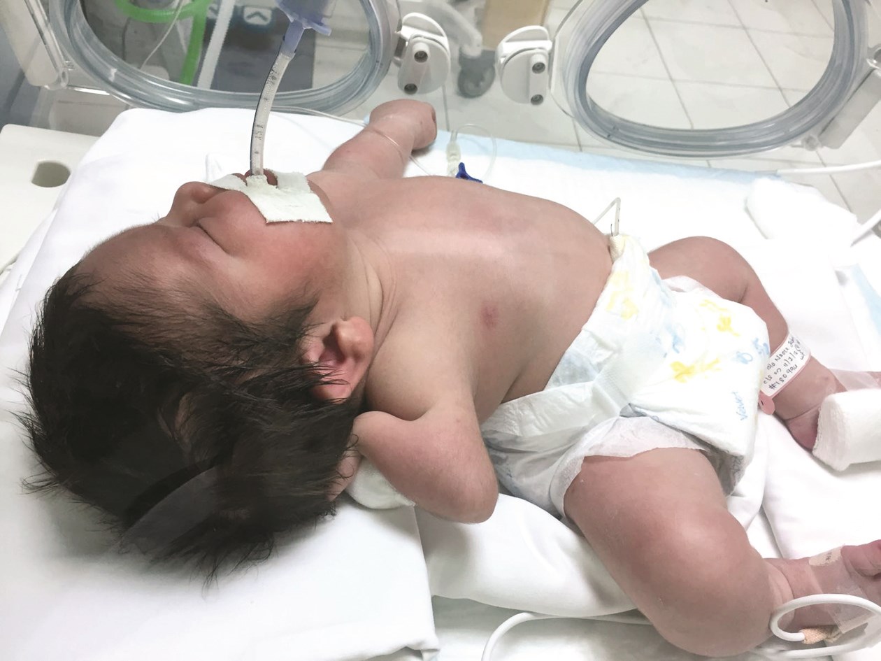 u0627u0644u0631u0636u064au0639 u0628u0639u062f u0648u0644u0627u062fu062au0647