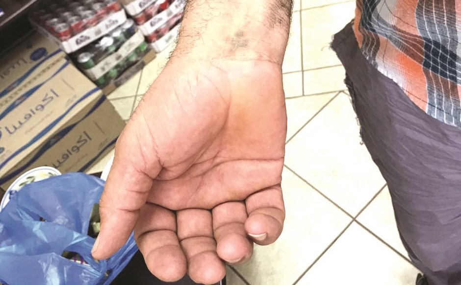 قصاب وشم على ساعده علامة الصليب