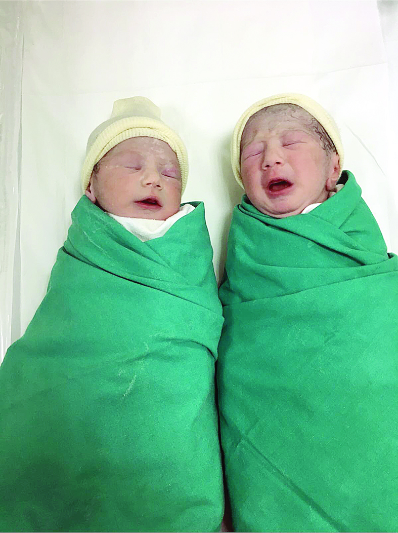 توأمان كويتيان... في مستشفى الولادة