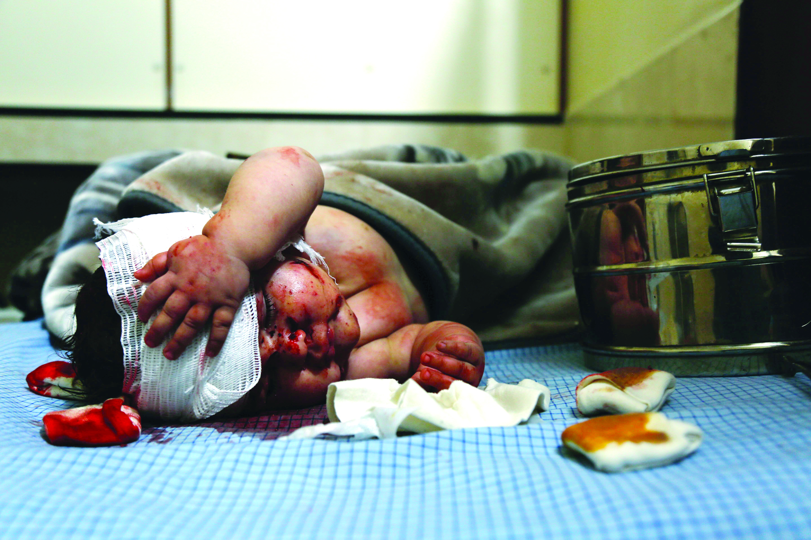 u0631u0636u064au0639 u0633u0648u0631u064a u0623u0635u064au0628 u0641u064a u063au0627u0631u0627u062a u0639u0644u0649 u0628u0644u062fu0629 u0645u0633u0631u0627u0628u0627 u064au062au0644u0642u0649 u0627u0644u0639u0644u0627u062c u0641u064a u0645u0633u062au0634u0641u0649 u0645u064au062fu0627u0646u064a u0628u062fu0648u0645u0627 u0641u064a u0627u0644u063au0648u0637u0629 u0627u0644u0634u0631u0642u064au0629 u0644u062fu0645u0634u0642t(u0627 u0641 u0628)