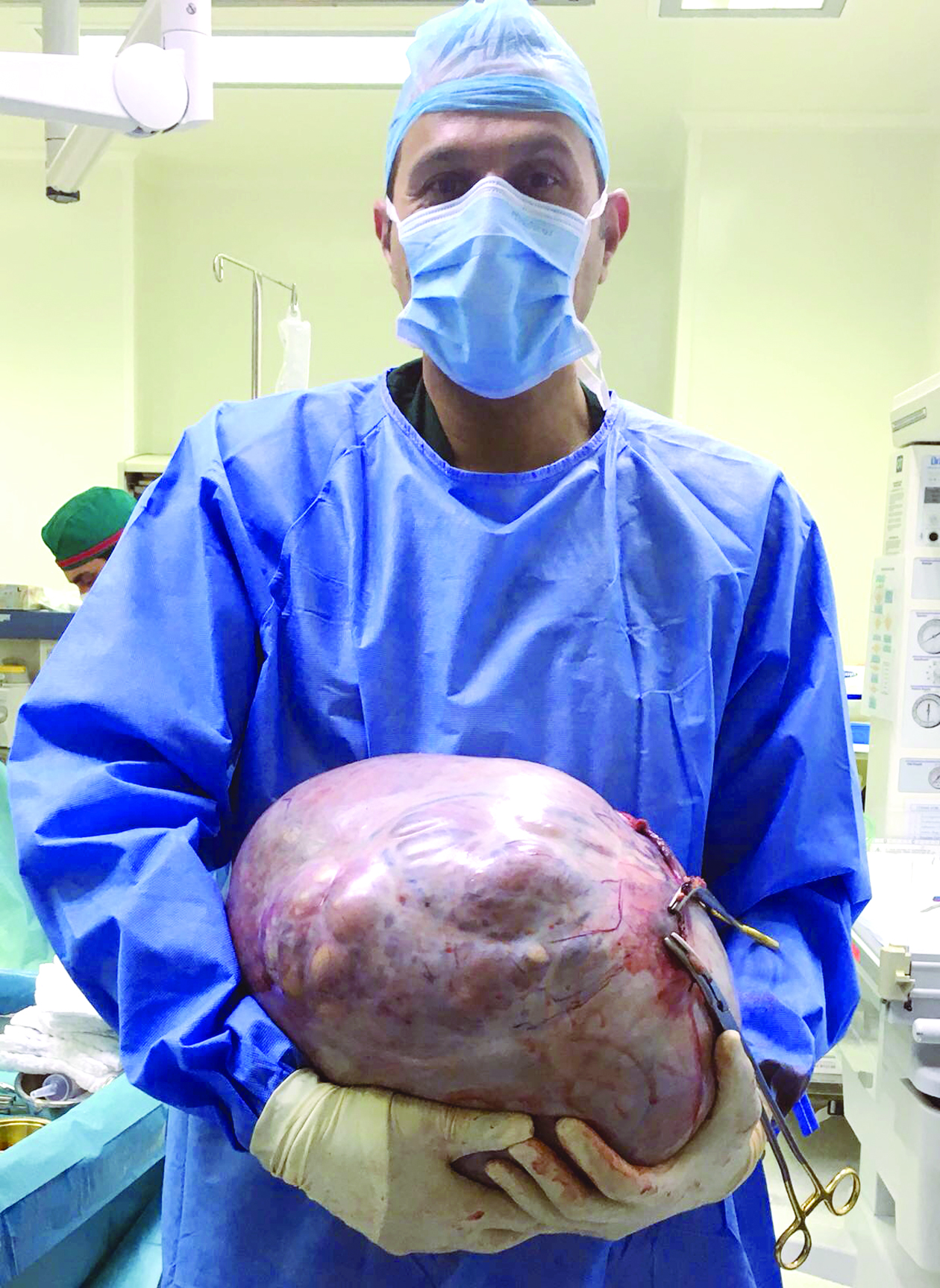  u0627u0644u062cu0633u0627u0631 u0648u0627u0644u0648u0631u0645 u0627u0644u0645u0633u062au0623u0635u0644