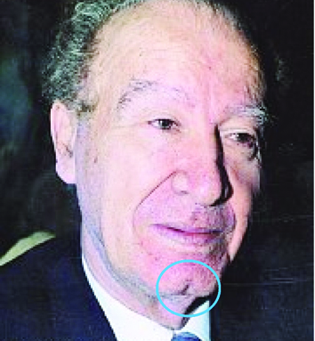 غمازة ذقن الشاعر الراحل عمر أبو ريشة