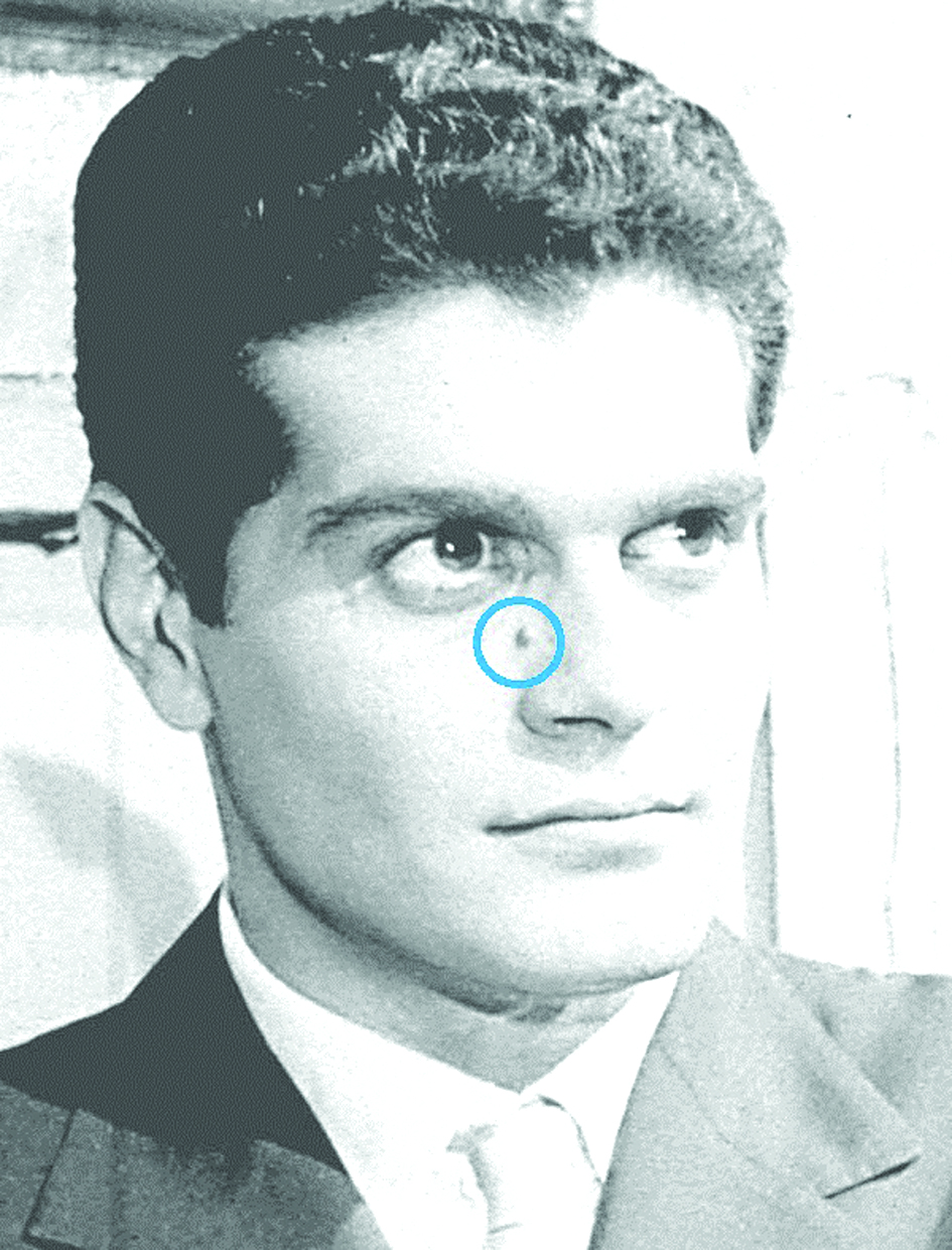 عمر الشريف... وشامته